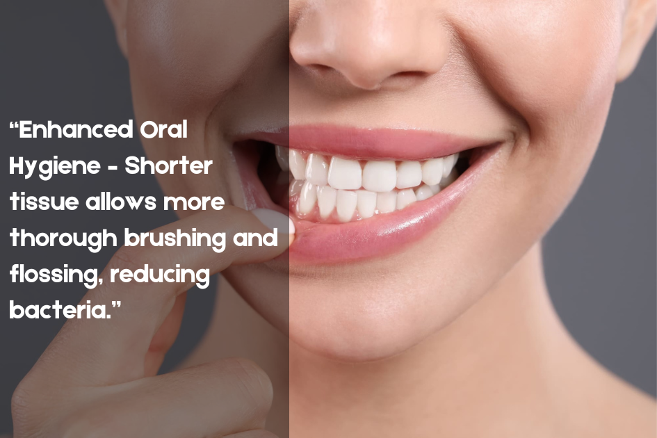 Enhanced oral hygiene through gum contouring, allowing thorough brushing and flossing at Pristine Family & Cosmetic Dentistry, San Antonio, TX.