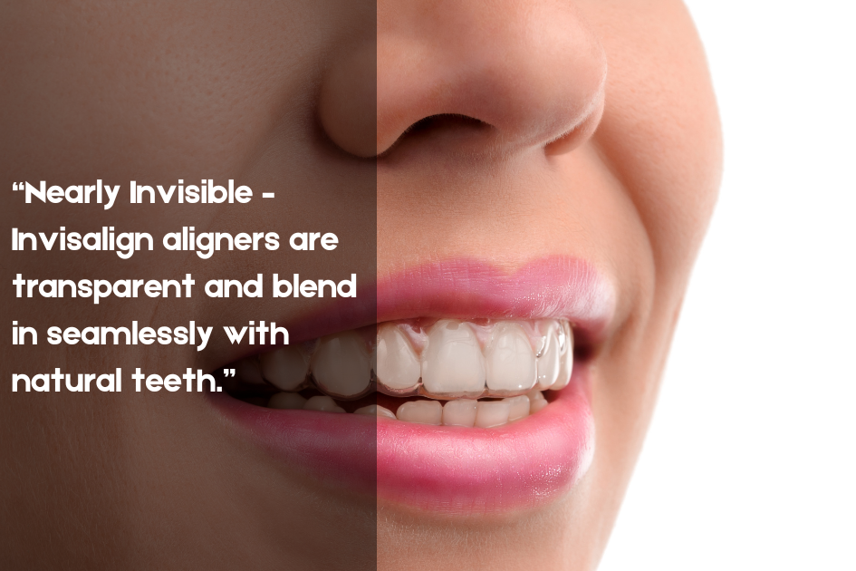Transparent Invisalign aligners offering a nearly invisible teeth straightening solution at Pristine Family & Cosmetic Dentistry, San Antonio, TX.