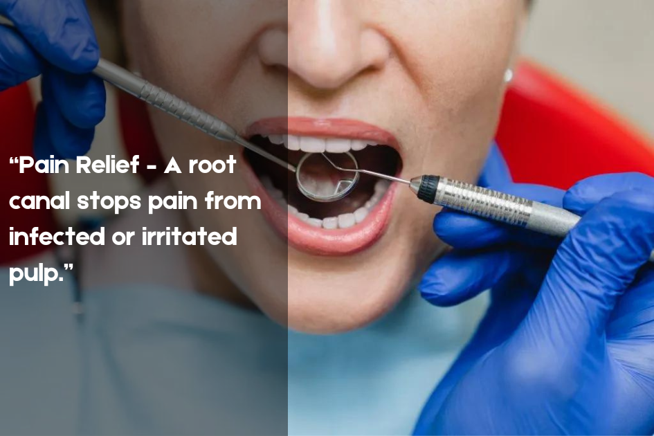Graphic explaining pain relief through Root Canals at Pristine Family & Cosmetic Dentistry, San Antonio, TX.