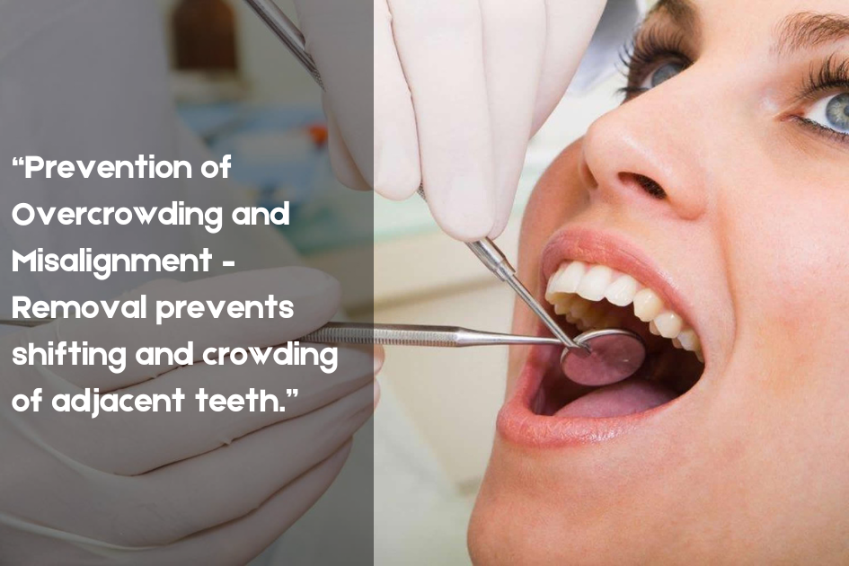 Illustration about preserving natural smile with Wisdom Tooth Removal at Pristine Family & Cosmetic Dentistry, San Antonio, TX.