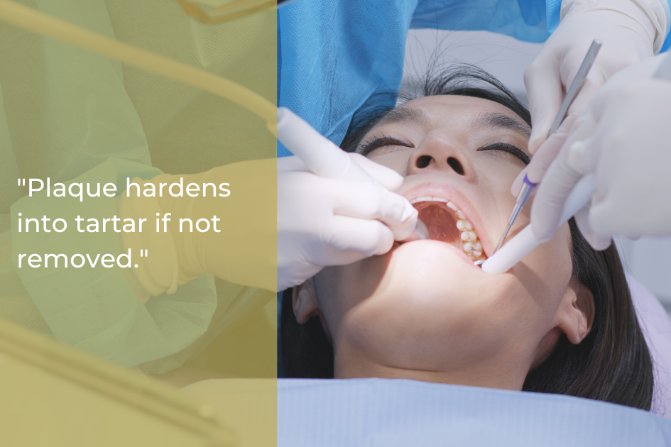 A dentist at Pristine Family & Cosmetic Dentistry performs a professional dental cleaning on a woman in a treatment chair, while a quote about plaque turning into tartar is displayed on the left.
