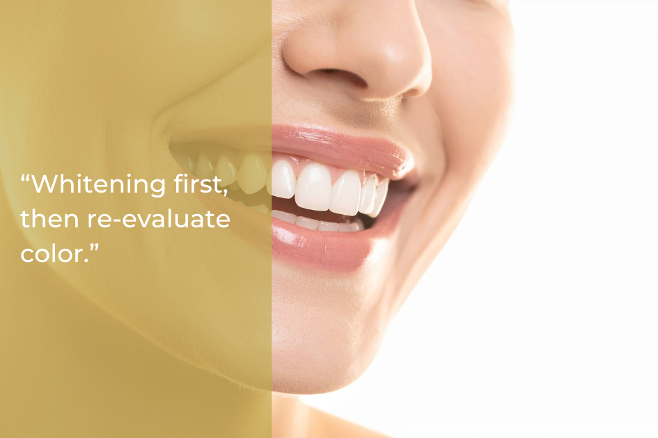 Close-up of a person smiling, showing white teeth, with the text "Whitening first, then re-evaluate color" overlaid on the left in a yellow-tinted section—perfect for planning your 2026 dental schedule or considering a complete dental reset.