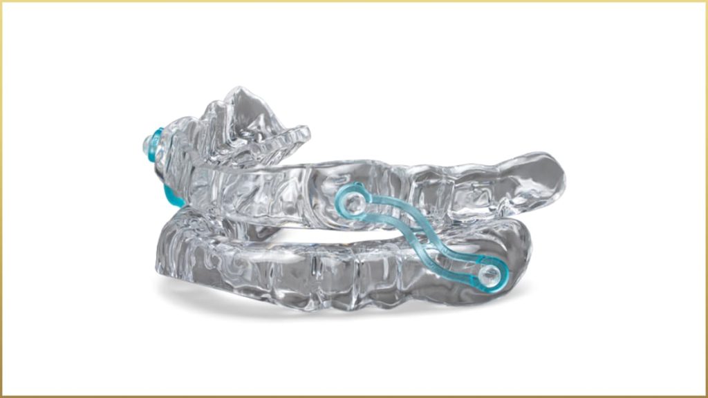 Clear dental appliance with blue adjustable connectors, designed to fit over upper and lower teeth, ideal for snoring treatment or sleep apnea relief, shown against a white background.